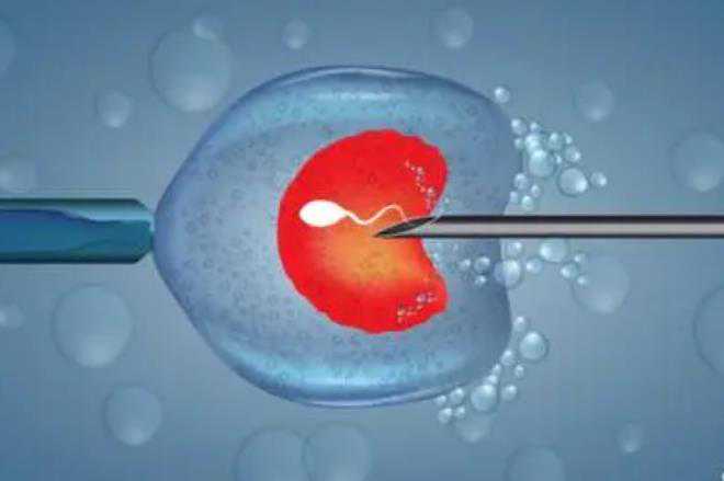 海南助孕指南：孕期腹痛不可忽视的信号与应对策略